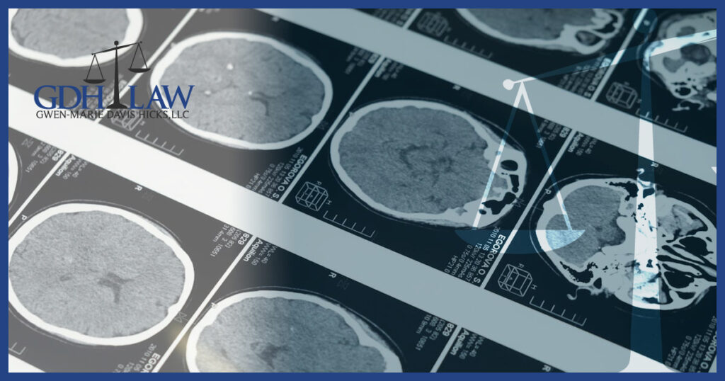 How a Traumatic Brain Injury (TBI) Can Change Your Life - GDH Law Firm