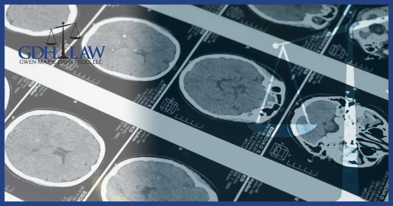 How a Traumatic Brain Injury (TBI) Can Change Your Life - GDH Law Firm